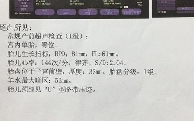 为何说32周一个坎34周一个坎